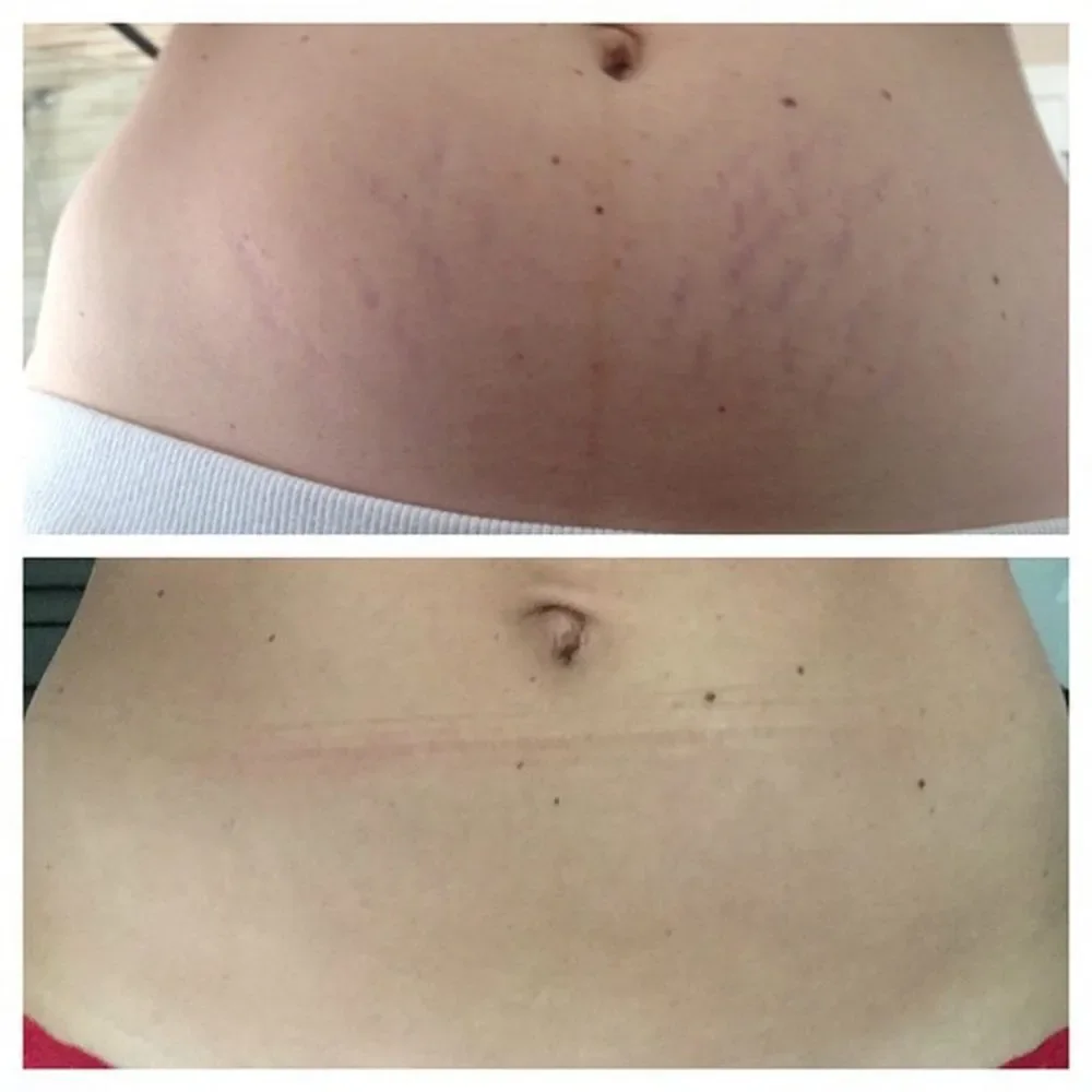 Frank Body Original and Coconut Scrub Duo